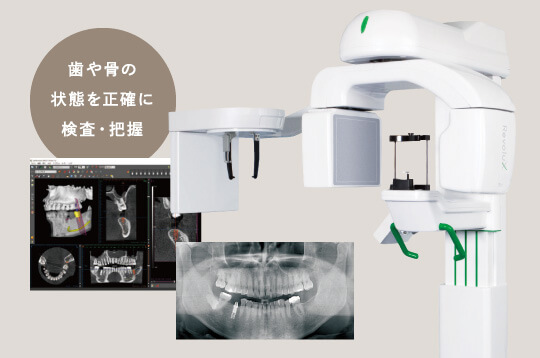 歯や骨の状態を正確に検査・把握