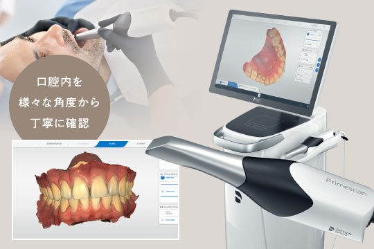 3D光学スキャナー「プライムスキャン」