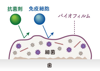 抗菌剤と免疫細胞を弾いてしまうバイオフィルム