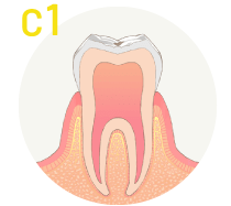 C1