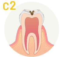 C1