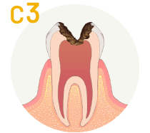 C1